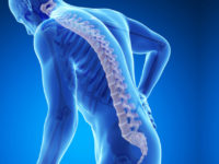 Osteoporosi, una malattia che preoccupa. Convegno ad Acquasanta Terme